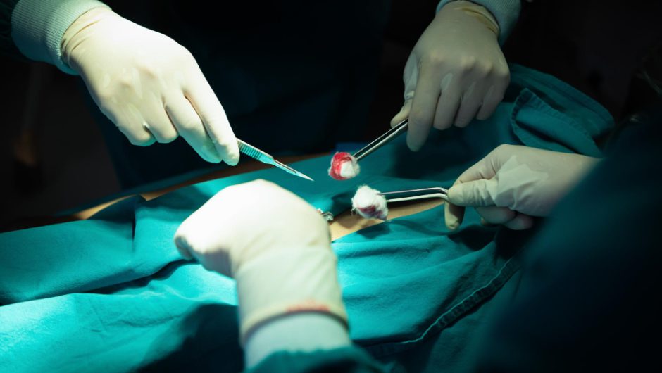 Costurile unei operații laparoscopice